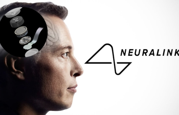 Neuralink uğurla ikinci xəstəyə çip implantasiya etdi