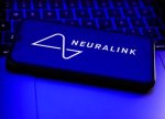 Maskın çılğın layihəsi Neuralink-də insan təcrübələri gəlir