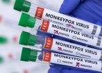 Meymunçiçəyi epidemiyasının yeni hüdudları