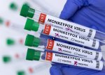 Azərbaycanda meymunçiçəyinin diaqnostikası və müalicəsi üçün bütün imkanlar mövcuddur - Səhiyyə Nazirliyi