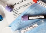 Gürcüstanda COVID-19-a yoluxma halları artıb