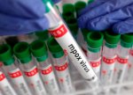 ÜST: Afrikada “mpox” virusuna 35 mindən çox şəxs yoluxub