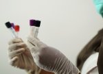 Avstraliya laboratoriyasında ölümcül virusu olan sınaq boruları yoxa çıxıb