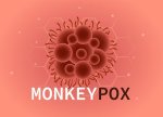 Azərbaycan meymunçiçəyi xəstəliyinin endemik risk qrupuna daxil deyil