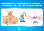 İcbari tibbi sığorta hesabına 1480-dən çox ilkin hemodializ xidməti göstərilib