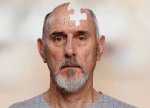 Alzheimer xəstəliyinə qarşı yeni müdafiə mexanizmi aşkarlandı