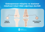 Osteoporozun müayinə və stasionar müalicəsi icbari tibbi sığortaya daxildir
