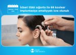 Koxlear implantasiya əməliyyatı zamanı implant və nitq prosessorunun xərclərini icbari tibbi sığorta qarşılayır