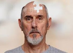Alzheimer xəstəliyinə qarşı yeni müdafiə mexanizmi aşkarlandı