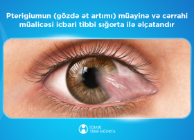 Ötən il ərzində icbari tibbi sığorta hesabına 2192 sayda gözdə ət artımı əməliyyatı icra olunub