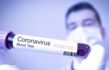 Azərbaycanda daha 9 nəfərdə koronavirus aşkarlandı
