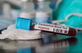 Azərbaycanda 29 yeni koronavirus yoluxması qeydə alınıb, 1 nəfər ölüb - RƏSMİ