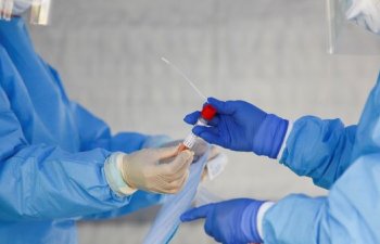Azərbaycanda daha 43 nəfər koronavirusa yoluxdu