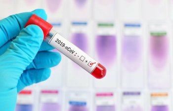 Azərbaycanda daha 27 nəfərdə koronavirus aşkarlandı