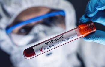 Azərbaycanda daha 61 nəfərdə koronavirus aşkarlanıb – RƏSMİ