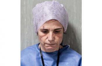 “Dove” COVID-19 -a görə reklam kampaniyasını dəyişdirdi – Video