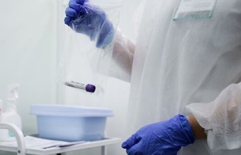 Avropada koronavirusa yoluxanların sayı bir milyonu keçdi - STATİSTİKA