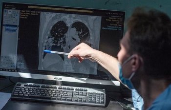 COVID-19-un ən qorxulu ağırlaşmaları açıqlandı