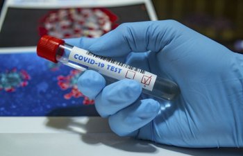 Braziliyada koronavirusdan ölənlərin sayı 16 mini ötüb