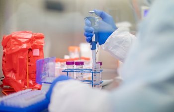 Azərbaycanda koronavirusla bağlı testlərin sayı açıqlandı - RƏSMİ