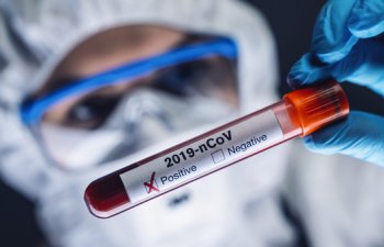 Azərbaycanda daha 257 nəfər koronavirusa yoluxub, 202 nəfər sağalıb
