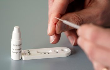 TƏBİB koronavirus testləri ilə bağlı məsələyə aydınlıq gətirdi