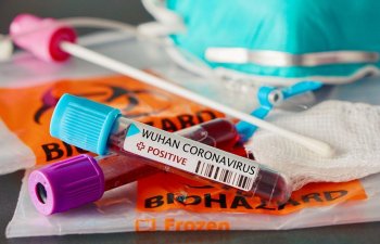 Azərbaycanda reanimasiyada olan koronavirus xəstələrinin sayı açıqlandı - STATİSTİKA