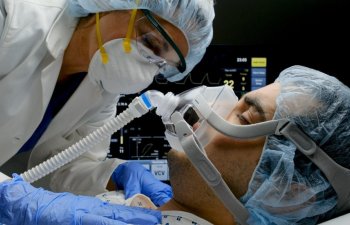 Reanimasiyada olan koronavirus xəstələrinin SAYI AÇIQLANDI