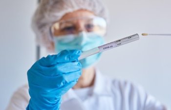 Azərbaycanda daha 639 nəfər COVID-19-dan sağalıb, 286 nəfər yoluxub