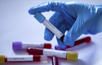 Dünyada koronavirusa yoluxma sayı 18 milyonu ötdü - STATİSTİKA