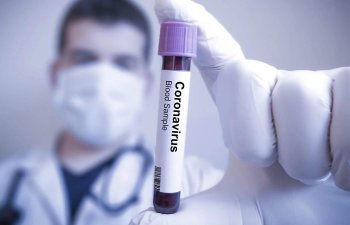 Dünyada koronavirus qurbanlarının sayı 700 mini ötdü
