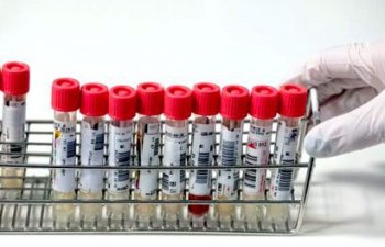 COVID-19 yoluxma hallarının müəyyənləşdirilməsi ilə əlaqədar daha 7883 test aparılıb