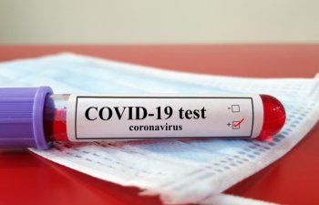 Dünyada COVID-19-dan ölənlərin sayı 737 mini keçdi