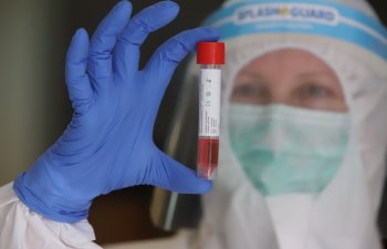 Azərbaycanda koronavirusa yoluxanların SAYI AÇIQLANIB