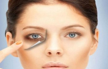 Gözaltı qaralmalar bu vitaminin əskikliyi ola bilər