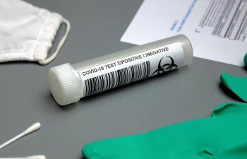 Koronavirusu saniyələr ərzində müəyyən edən test hazırlandı