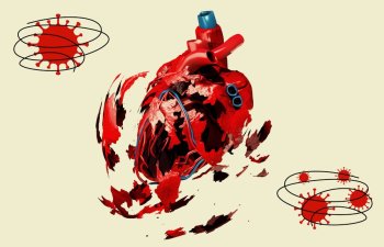 COVID-19 keçirmiş insanların ürəyində koronavirus izi aşkarlanıb