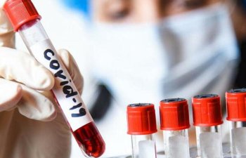 Koronavirusla qripi ayırd edən test hazırlanır - Nazirlik hərəkətə keçdi