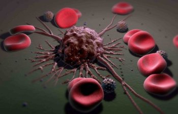 Alimlər xərçəng xəstəliyinin metastazına üstün gəlmək üsulunu tapıblar
