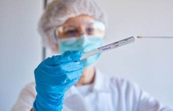 Azərbaycanda daha 647 yeni yoluxma faktı qeydə alınıb