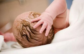 Uşağın göbəyinin kəsilməsi mütləq lazımdırmı?