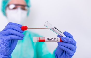 Azərbaycanda koronavirusa rekord yoluxma qeydə alındı