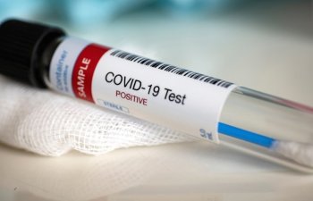 Alimlər COVID-19-un müəyyənləşdirilməsinin yeni yolunu tapdılar