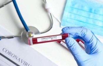 Koronavirusdan qorunmaq üçün bu dərmanlar lazımdır