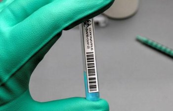 Həkim koronavirusdan kimin maksimum müdafiə altında olduğunu açıqladı