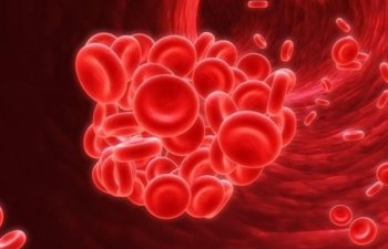 Dəmir defisit anemiyanın müalicəsi
