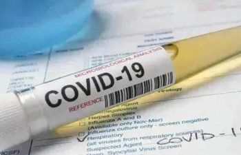 Koronavirusa yoluxanların əksəriyyətində vitamin çatışmazlığı var