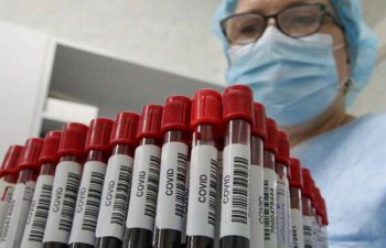 Koronavirusa yoluxmayanlarda antikorlar tapıldı