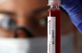 Azərbaycanda indiyədək 1562442 koronavirus testi aparılıb