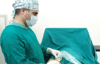 Varikozun yaranma səbəbləri - Dr. Emin Hüseynov